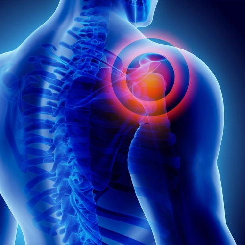 X-ray style image of a shoulder joint with a red target highlighting shoulder pain or injury.