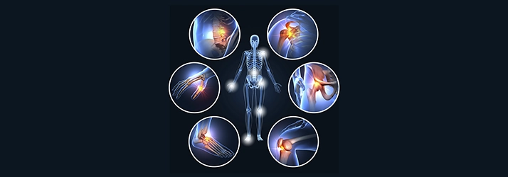 Human skeleton surrounded by callouts showing pain in multiple joints, including the neck, shoulder, elbow, wrist, hip, and knee.